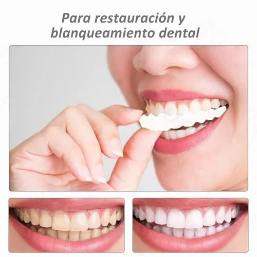 Carillas Snap On Smile®
