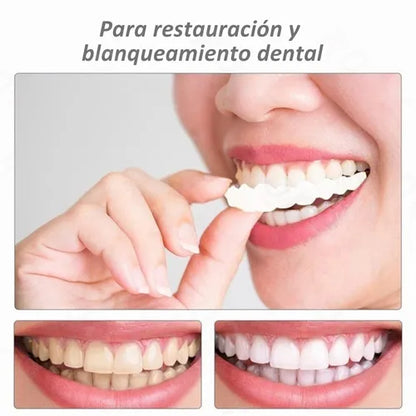 Carillas Snap On Smile®