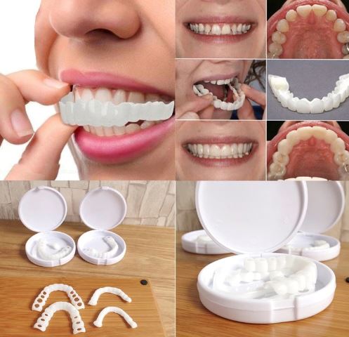 Carillas Snap On Smile®
